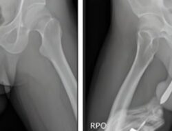 Kisah Tragis, Pria Indonesia Alami Cedera Serius Akibat Tindakan Seksual Berbahaya