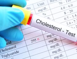 Tips Diet untuk Mengurangi Kolesterol, Hindari Lemak Trans