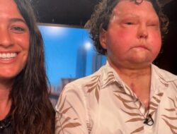 Joe DiMeo dan Jessica Koby Tunjukkan Cinta Sejati, Tanpa Mempermasalahkan Fisik