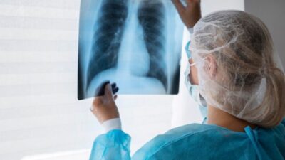 TB Paru Menular, TBC Dapat Serang Organ Lain