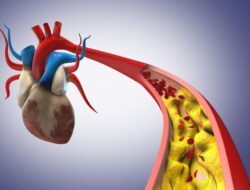 Tindakan Medis Terdepan di Mayapada Hospital untuk Menangani Serangan Jantung dan Aritmia