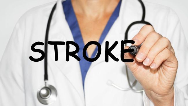 Golongan darah A disebut lebih rentan terkena stroke di usia muda.