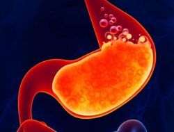 Puasa Lancar Tanpa Nyeri Ulu Hati, Coba Konsumsi Makanan Ini Saat Sahur dan Berbuka