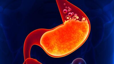 Puasa Lancar Tanpa Nyeri Ulu Hati, Coba Konsumsi Makanan Ini Saat Sahur dan Berbuka