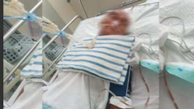 Nenek RD (64), korban kekerasan