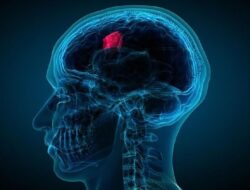 Air Mata Berpotensi Bantu Deteksi Tumor Otak